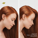 Dove Density Boost Conditioner, Hydrating Scalp + Hair Therapy for Dry Hair with Vitamin B3 and Zinc, 0% Sulfates, 9.25 oz